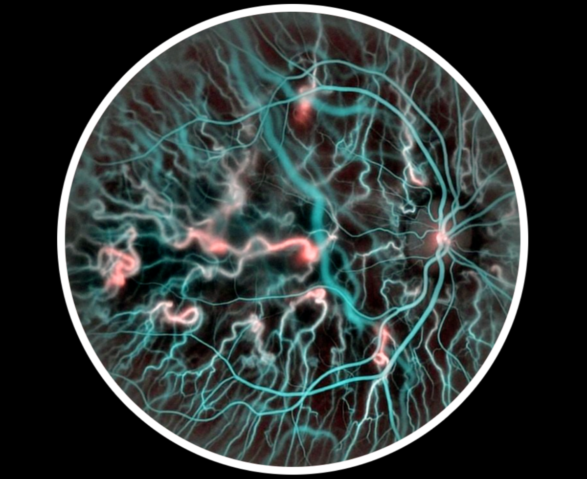 Doppler Holography